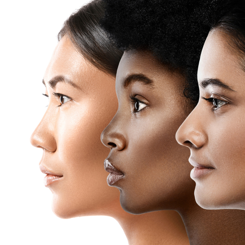 moxi laser treatment works for all skin types in winter park, florida